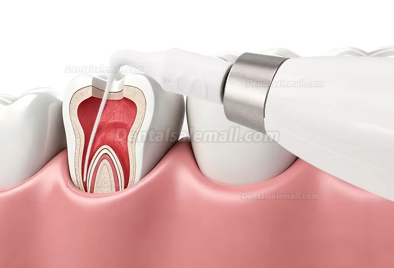 Dental Wireless Endoactivator Ultrasonic Endo Activator with 20 Tips